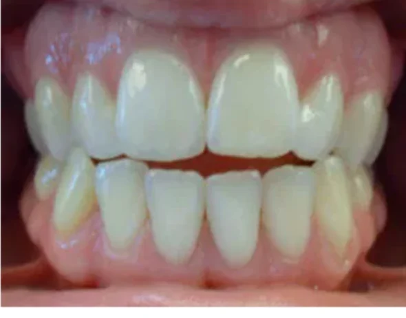 Case 3: smile before orthodontic treatment